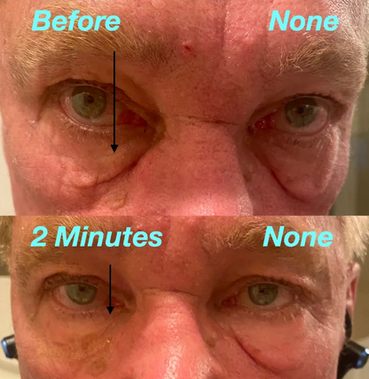 Better Than Botox Eye Serum - 30 Days Transformation
