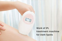Work of IPL treatment machine for Dark Spots