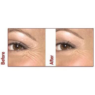 France Laure - The Duo-Lift System: An at Home Botox Replacement - Breizh Esthetic & Salon Supply - 4