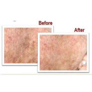 France Laure - Lumiperfection - Dark Spot Skin Lightening Treatment - Breizh Esthetic & Salon Supply - 2